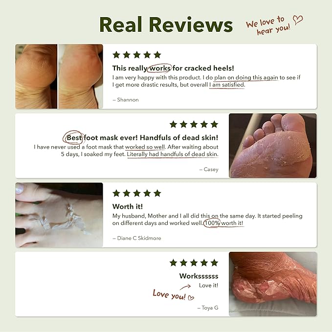 Purederm Shiny & Soft Foot Peeling Mask - Image 8