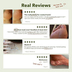 Purederm Shiny & Soft Foot Peeling Mask - Image 6
