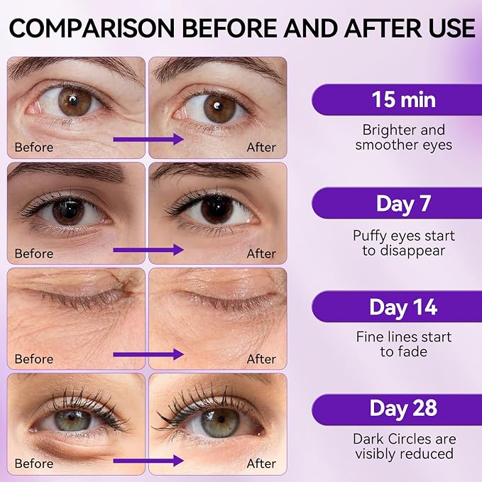 BREYLEE Retinol Eye Mask Under Eye Patches - Image 6