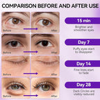 BREYLEE Retinol Eye Mask Under Eye Patches - Image 6