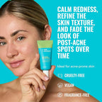 Good Molecules 10% Azelaic Acid Treatment - Image 2