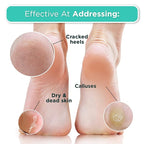 DERMORA Foot Peel Mask | Skin Exfoliating Foot Masks - Image 5