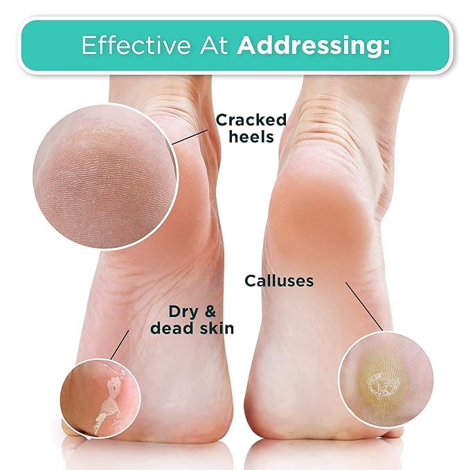 DERMORA Foot Peel Mask | Skin Exfoliating Foot Masks - Image 5