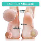 DERMORA Foot Peel Mask | Skin Exfoliating Foot Masks - Image 4