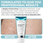 Keratosis Pilaris Treatment | Keratosis Pilaris Lotion - Image 4