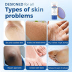 OUKEYA Urea Cream 40 Percent Tube, Urea Cream 40 Percent - Image 3