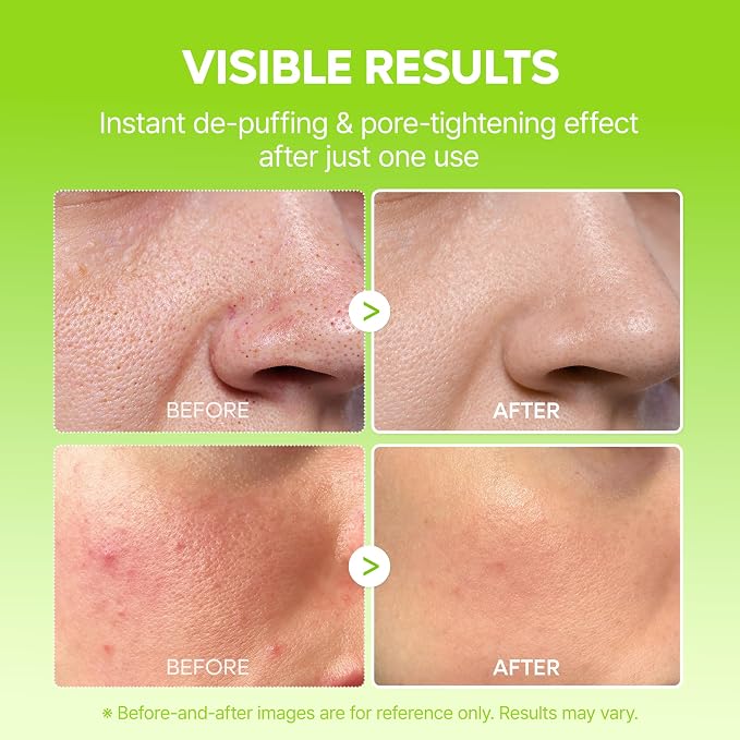 Dr.Melaxin Cactox Pore Relief Jelly Serum Mist, Instant Cooling Face Mist - Image 3