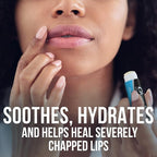 ChapStick Classic Medicated Lip Balm Tubes, Chapped Lips Treatment and Skin - Image 2