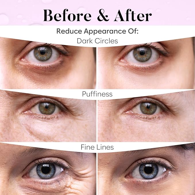 BLOOMORA PDRN, Caffeine & Collagen Under Eye Patches, Under Eye Mask - Image 4