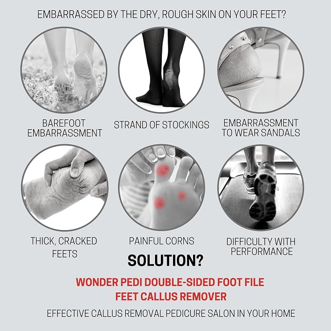 Made in Germany Double Sided Foot File Callus Remover, Stainless Steel and - Image 2