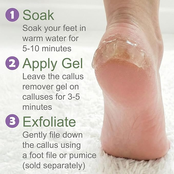 Dr. Entre's 16oz Callus Remover Gel: Extra Strength Value Size, Callus Remover - Image 6