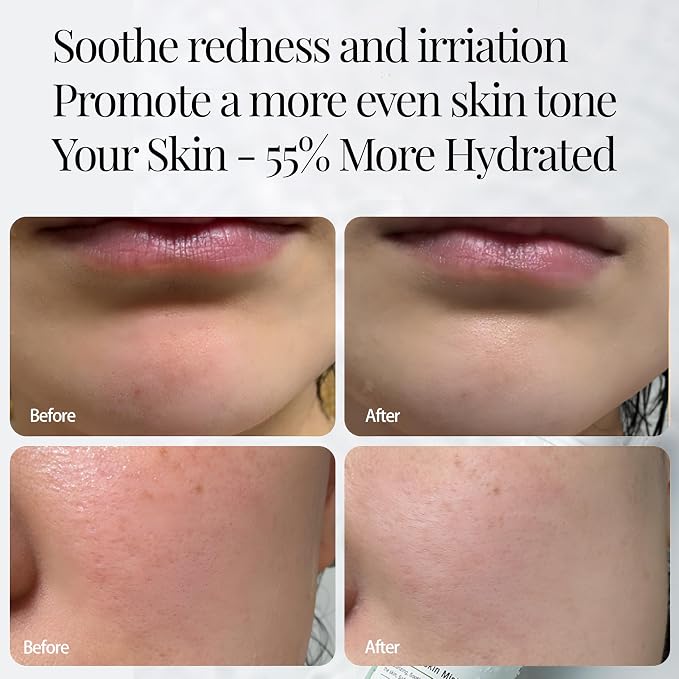 CICA Aloe Hydrating Toner Spray - Image 4