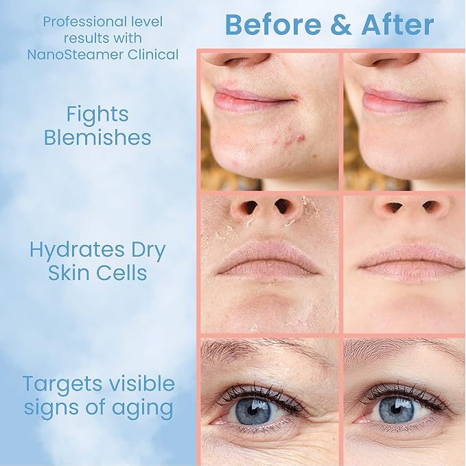 Pure Daily Care NanoSteamer Clinical 10-in-1 Smart Dermatologist Grade Ionic - Image 7