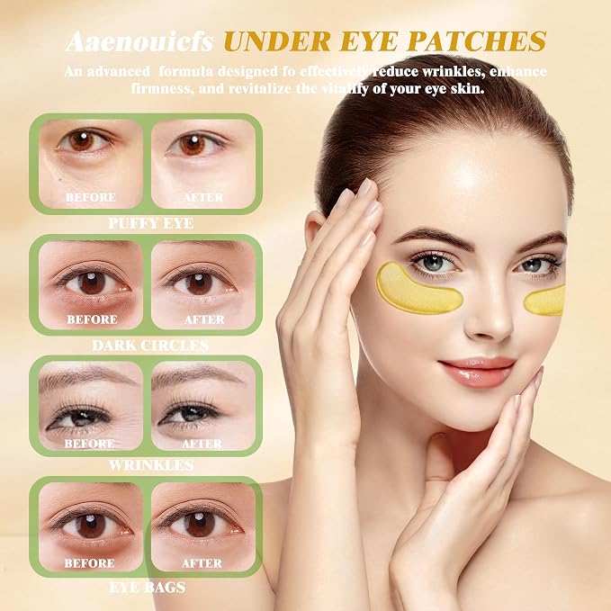 Clay Mask Set Gold Eye Patches, Mud Mask Deep Pore Cleansing Acne Blackhead - Image 3