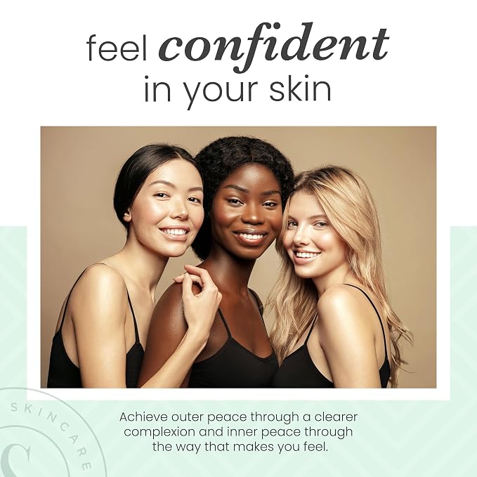 Sdara Skincare Derma Roller Microneedling Roller - Image 9