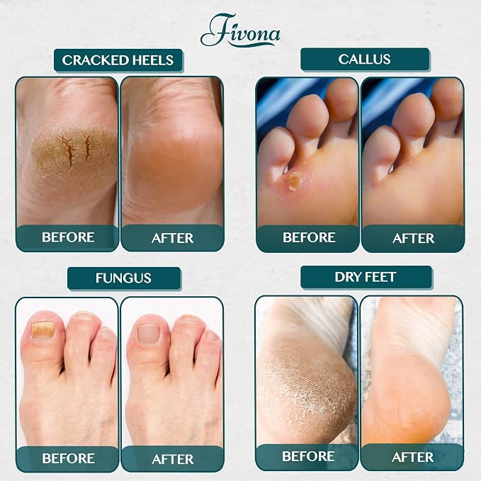 Foot Soak Epsom Salt with Tea Tree Oil 2 LB - Image 8