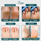 Foot Soak Epsom Salt with Tea Tree Oil 2 LB - Image 8