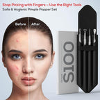 Suvorna Pimple Popper Tool Kit | Milia Remover | Lancets - Image 6