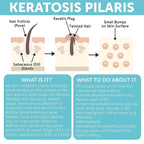 Body Soap for Keratosis Pilaris | Exfoliating Soap Scrub - Image 5