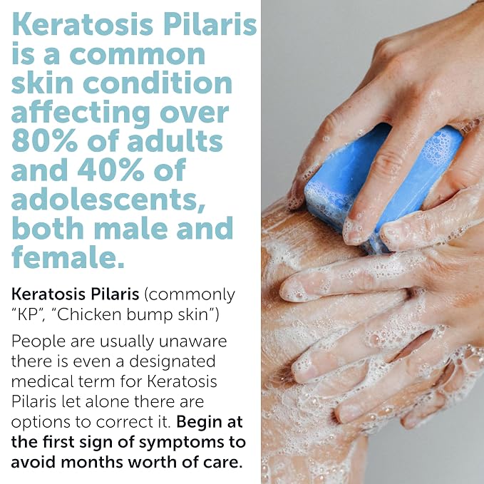 Body Soap for Keratosis Pilaris | Exfoliating Soap Scrub - Image 4