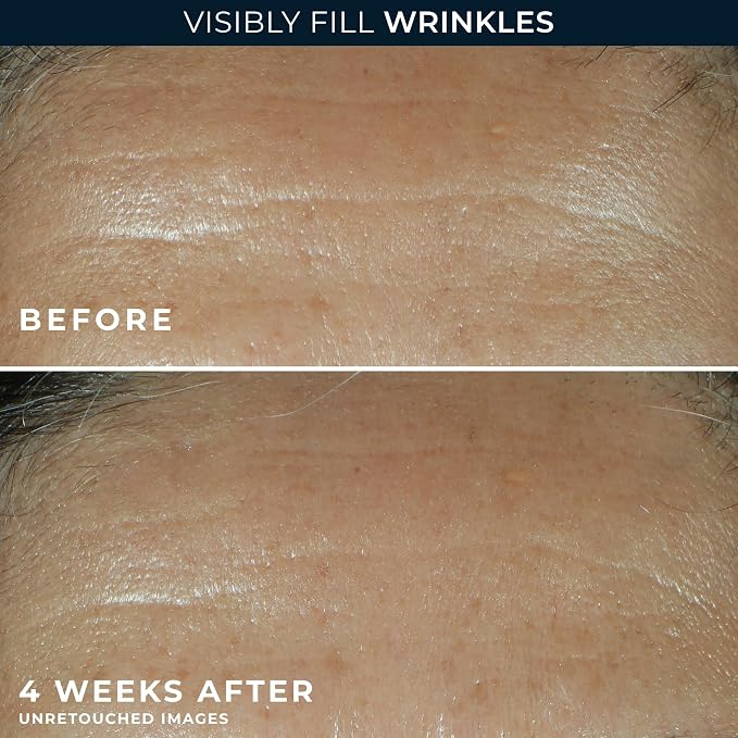 RoC Retinol Correxion Wrinkle Filler - Image 4