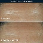 RoC Retinol Correxion Wrinkle Filler - Image 4