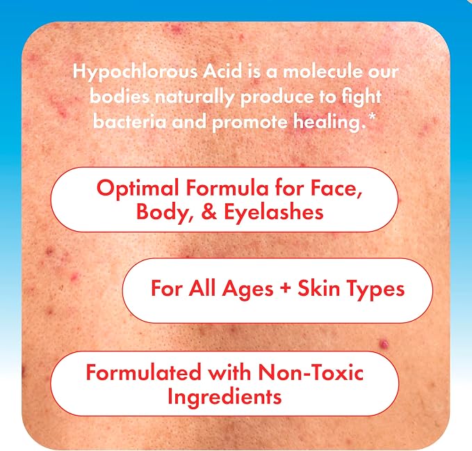 Hypochlorous Acid Spray for Face, Skin & Eyelids – pH-Balanced HOCl Facial - Image 4