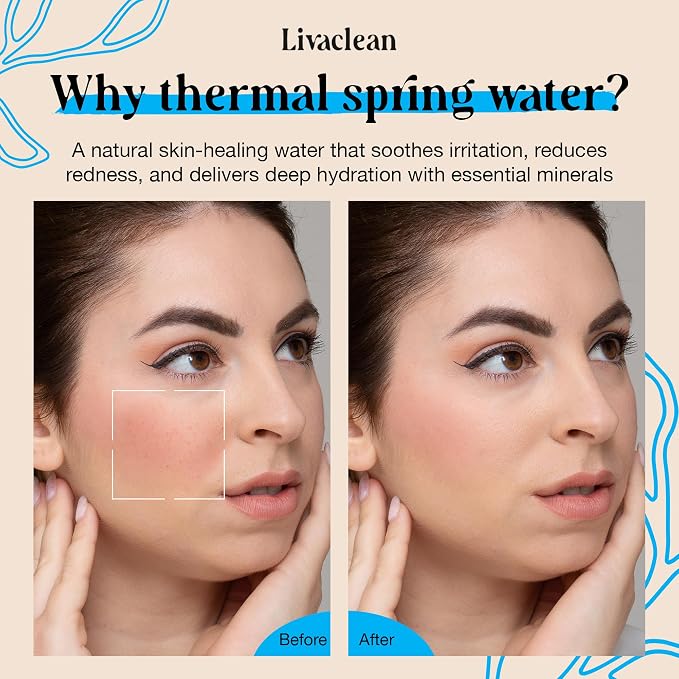 300ml + 50ml Thermal Spring Water Face Spray Mist Hydrating w/ Hyaluronic Acid - Image 5
