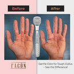 Facón Professional Callus Shaver Remover - Image 4