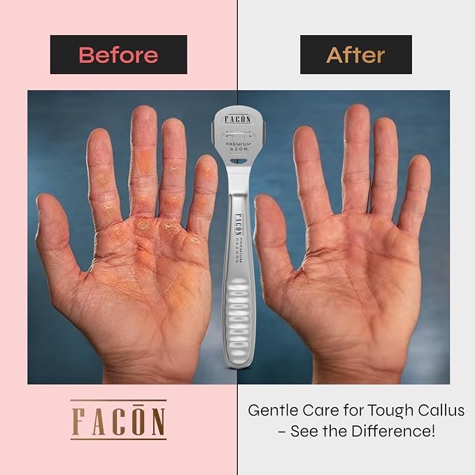 Facón Professional Callus Shaver Remover - Image 4