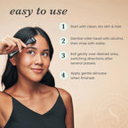 Sdara Skincare Derma Roller Microneedling Roller - Image 6