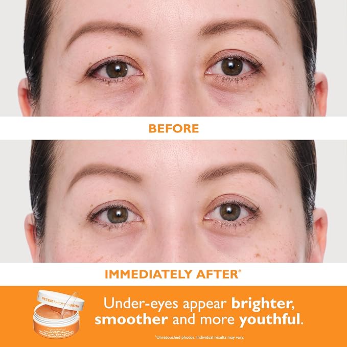 Peter Thomas Roth | Full-Size Vitamin C & Hyaluronic Eye Patches 2-Piece Kit - Image 4