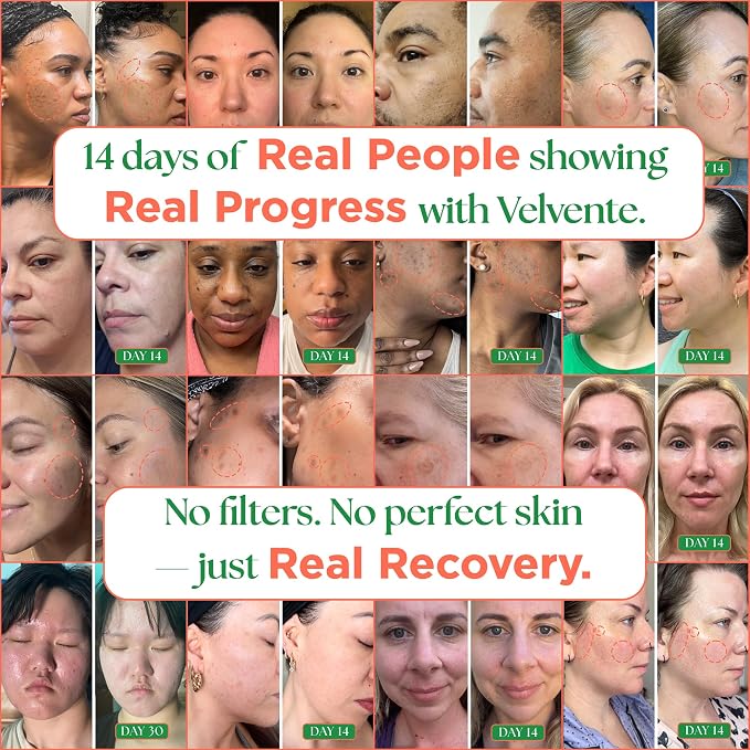 Matcha Toner Pads with Rose PDRN, Peptides & Hyaluronic Acid | Korean Facial - Image 5