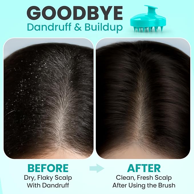 RELAXXO Scalp Massager Hair Growth – Exfoliator & Hair Scrubber - Image 3
