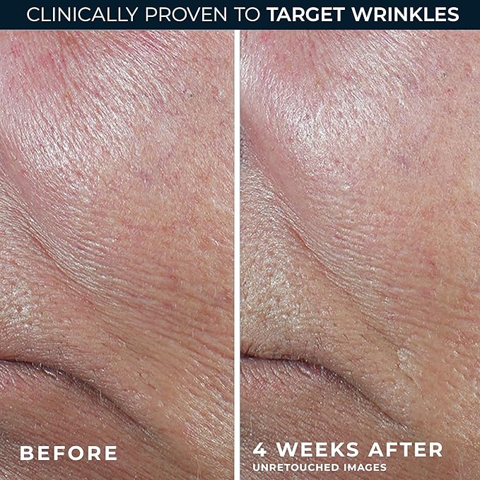 RoC Derm Correxion Retinol Firming Serum Stick - Image 5