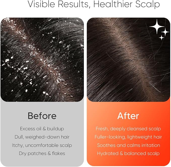 EKZ Sonic Vibrating Scalp Massager Shampoo Brush: Electric Silicone Hair - Image 4