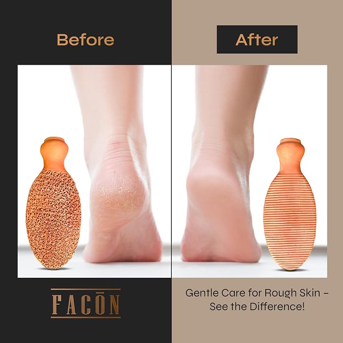 Facón Pumice Stone for Feet Callus Remover - Image 6
