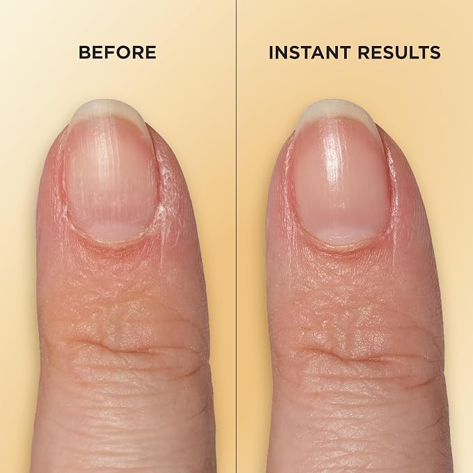 Sally Hansen Vitamin E Nail & Cuticle Treatment Pen | Hydrates and Conditions - Image 5