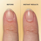 Sally Hansen Vitamin E Nail & Cuticle Treatment Pen | Hydrates and Conditions - Image 5
