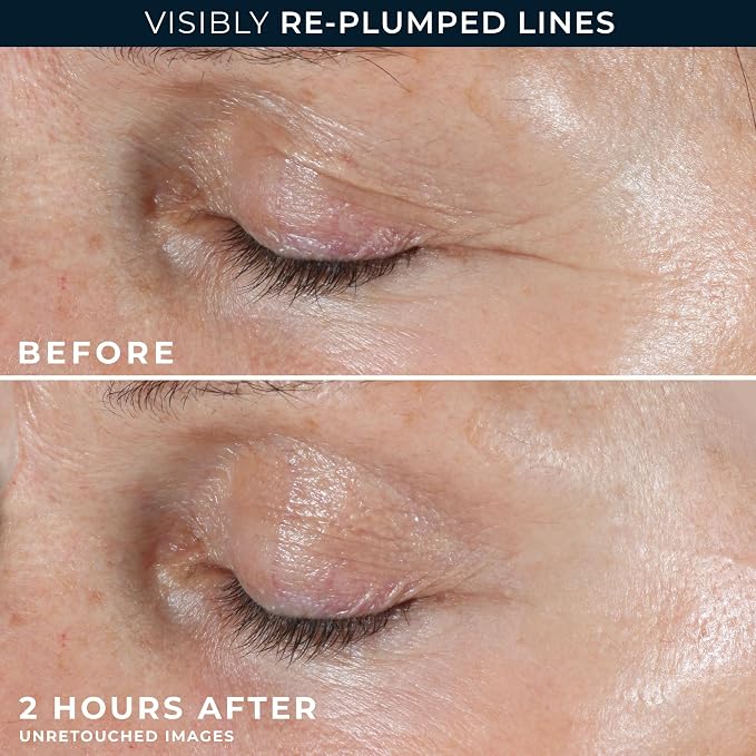 RoC Retinol Correxion Deep Wrinkle Non-Invasive Targeted Patches - Image 5