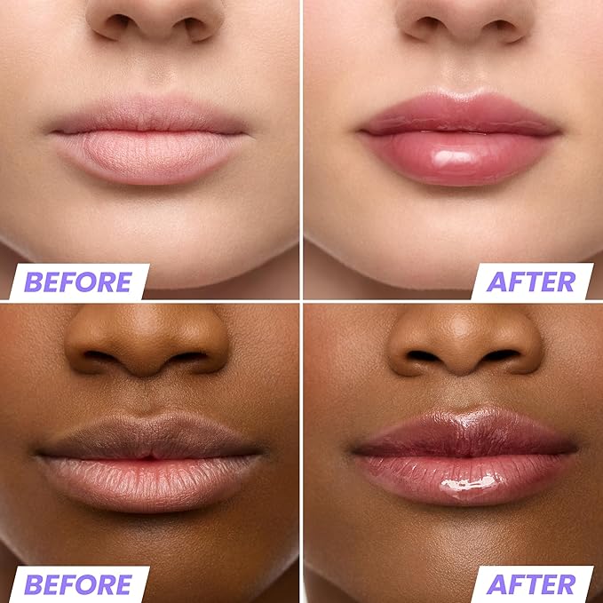 Wonderskin Lip Oil Rehab Serum - Image 3