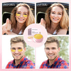 Under Eye Mask, Peptide Collagen Hydrogel Eye Patch - Image 7
