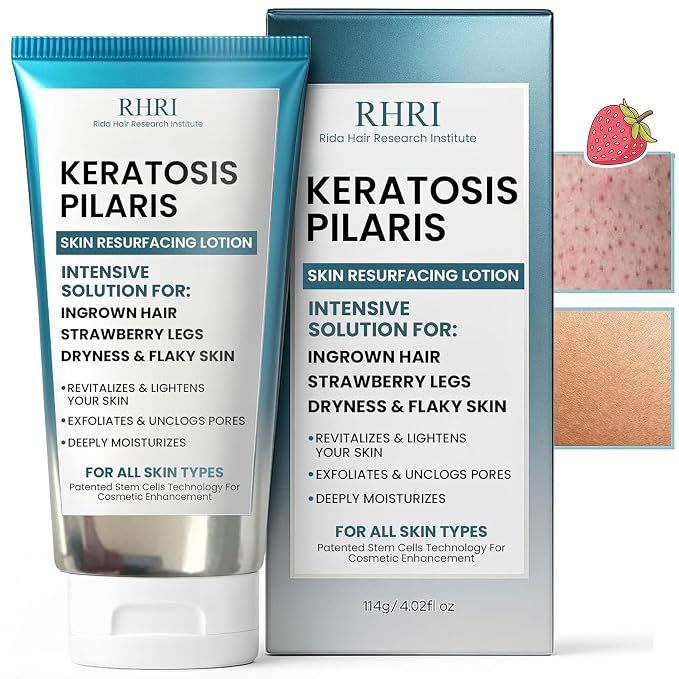 Keratosis Pilaris Treatment | Keratosis Pilaris Lotion by RidaHairResearchInstitute