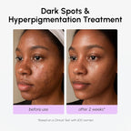 MAREE 20% Tranexamic Acid Serum Complex - Image 6