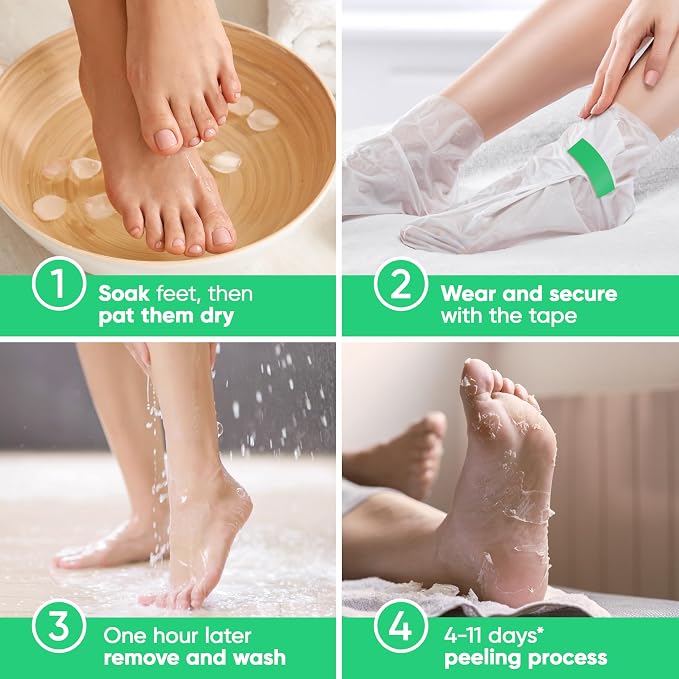 Foot Peel Mask - Foot Mask for Baby Soft Skin - Remove Dead Skin, Cracked Feet - Image 2