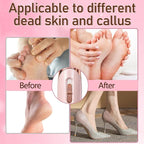 Callus Remover for Feet，Electric Foot Callus Remover - Image 4