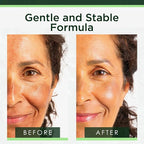 Tree of Life Niacinamide Serum For Face - Image 3