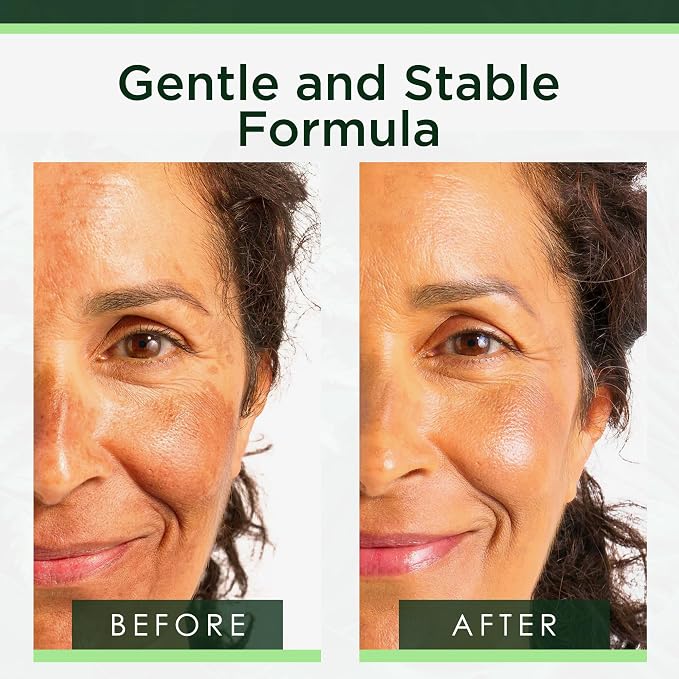 Tree of Life Niacinamide Serum For Face - Image 3