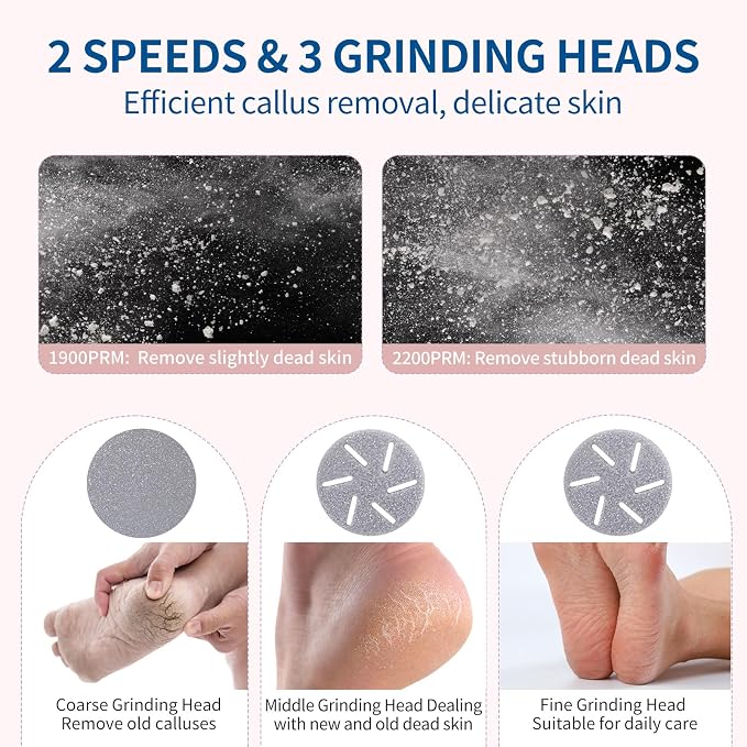 Electric Foot Callus Remover - Image 2