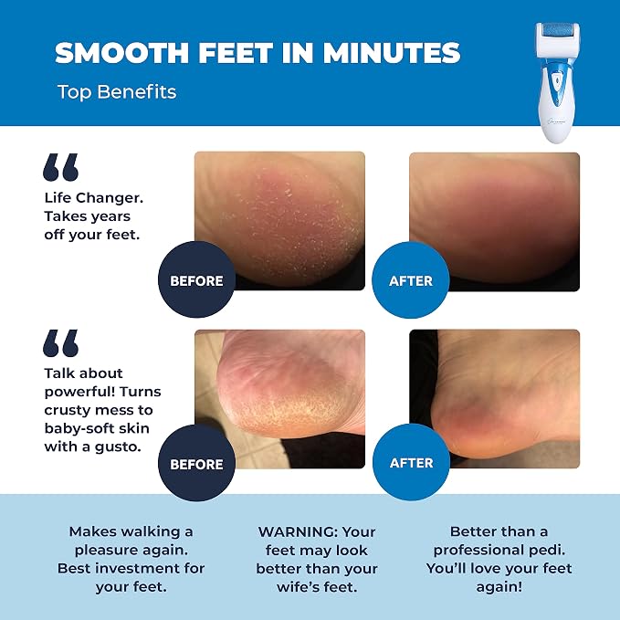 Electric Callus Remover: Own Harmony Professional Pedicure Tools Foot Care - Image 2